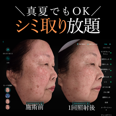 EveV画像