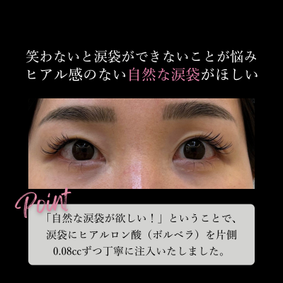 施術前画像