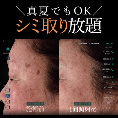 EveV画像
