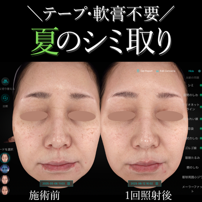 EveV画像