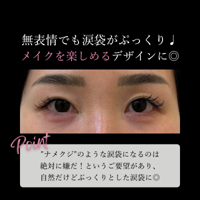 施術後画像