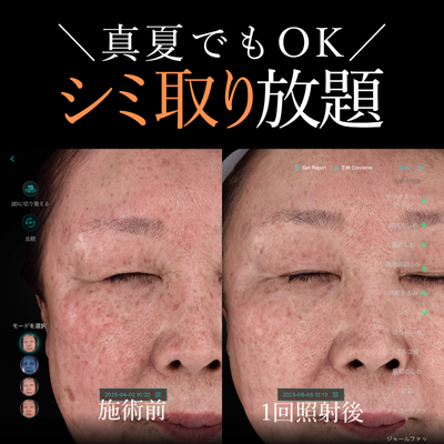 EveV画像